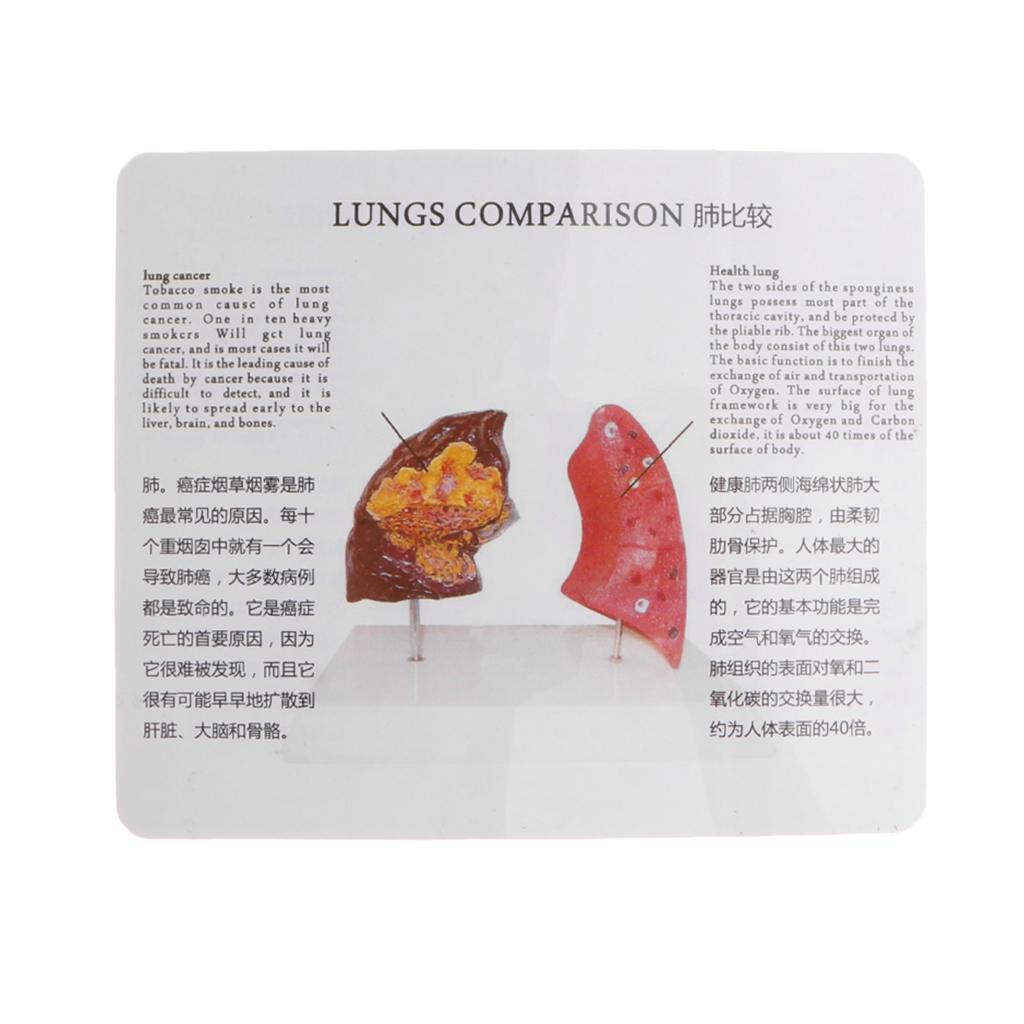 Human Lung Normal Comparison M – Medical Lab Supplies Bewertung und Preis