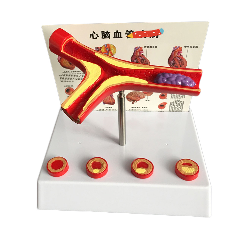 50 Times Enlarged Human Vessel – Medical Lab Supplies Bewertung und Preis