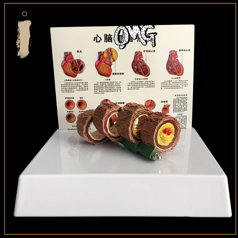 50 Times Enlarged Human Vessel – Medical Lab Supplies Bewertung und Preis